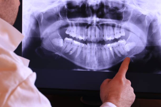 Best Mobile Emergency Dentist in Asotin, WA