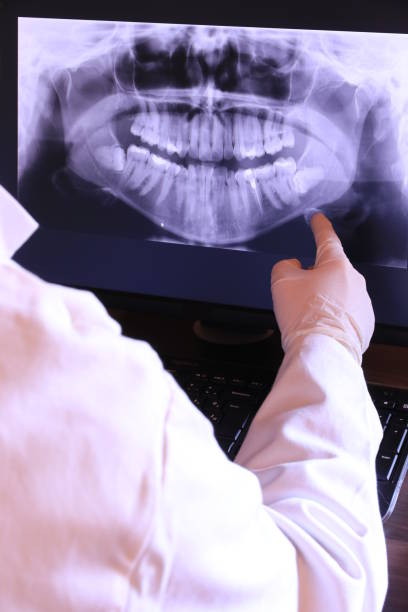 Best Emergency Dental Extractions in Asotin, WA